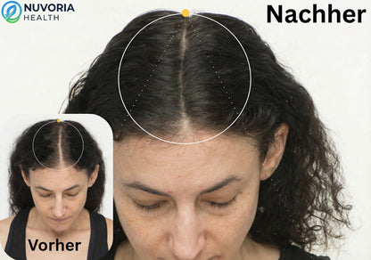 Haaransatz- & Kopfhaut-Serum